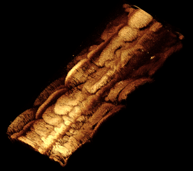 醫(yī)用介入器械聯(lián)合實(shí)驗(yàn)室 醫(yī)用介入器械聯(lián)合實(shí)驗(yàn)室